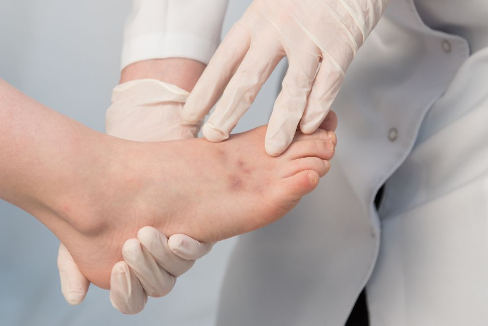 足の爪の施術　診察