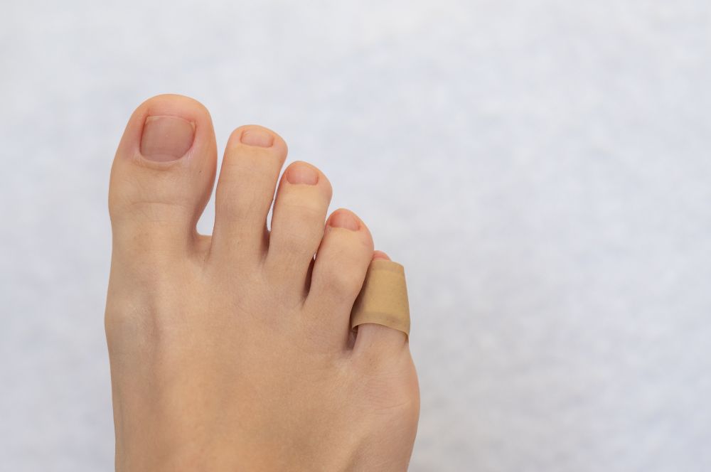 深爪で絆創膏をする足の指
