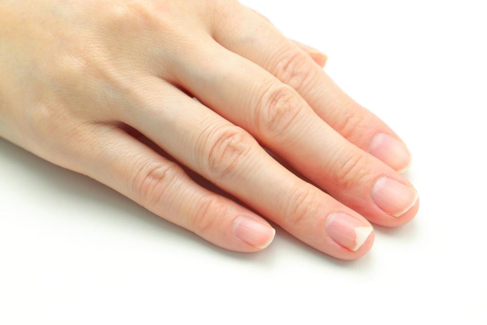 爪の白い部分が広がる「爪甲剥離症」とは?原因や治療について解説 | 専門医と学ぶ 巻き爪・陥入爪治療の相談室