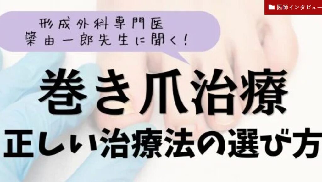 巻き爪治療